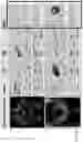 Fig. 26 - DIFFUSION DICTIONARY IMAGING (DDI) OF MICROSTRUCTURE AND INFLAMMATION