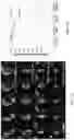 Fig. 41 - DIFFUSION DICTIONARY IMAGING (DDI) OF MICROSTRUCTURE AND INFLAMMATION