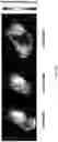 Fig. 42 - DIFFUSION DICTIONARY IMAGING (DDI) OF MICROSTRUCTURE AND INFLAMMATION