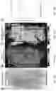 Fig. 45 - DIFFUSION DICTIONARY IMAGING (DDI) OF MICROSTRUCTURE AND INFLAMMATION