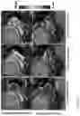 Fig. 46 - DIFFUSION DICTIONARY IMAGING (DDI) OF MICROSTRUCTURE AND INFLAMMATION