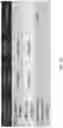 Fig. 51 - DIFFUSION DICTIONARY IMAGING (DDI) OF MICROSTRUCTURE AND INFLAMMATION