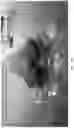 Fig. 53 - DIFFUSION DICTIONARY IMAGING (DDI) OF MICROSTRUCTURE AND INFLAMMATION