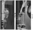 Fig. 03 - LIDAR system with variable resolution multi-beam scanning