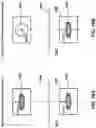 Fig. 16 - Location determination for subsurface communication device