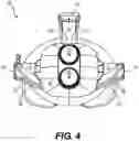 Fig. 05 - Adjustable head-mounted display