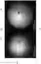 Fig. 06 - Reduced Speckle Illumination Systems And Methods