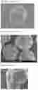 Fig. 02 - TONER HAVING SPECIAL SURFACE FEATURES AND METHOD TO MAKE THE SAME