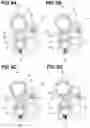 Fig. 06 - Oldham coupling and image forming apparatus