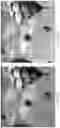 Fig. 08 - Light field vision testing device, adjusted pixel rendering method therefor, and vision testing system and method using same