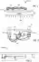 Fig. 02 - Pleat counter
