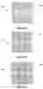 Fig. 08 - ARTIFICIAL NEURAL NETWORK IMPLEMENTATION