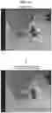 Fig. 17 - Image processing device and image processing method for correcting a depth value of a pixel or region of an image based on a contribution ratio