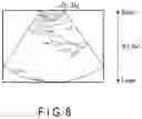 Fig. 09 - ULTRASONIC DIAGNOSTIC SYSTEM AND ULTRASOUND IMAGE PROCESSING METHOD