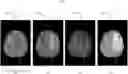 Fig. 01 - Learning classifier for brain imaging modality recognition