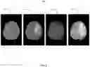 Fig. 03 - Learning classifier for brain imaging modality recognition