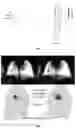 Fig. 02 - Device and method for evaluating dark field images