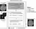 Fig. 01 - Retrospective motion correction using a combined neural network and model-based image reconstruction of magnetic resonance data
