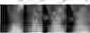Fig. 01 - REGISTRATION OF TIME-SEPARATED X-RAY IMAGES