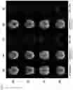 Fig. 06 - B0 field inhomogeneity estimation using internal phase maps from long single echo time MRI acquisition