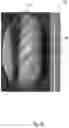 Fig. 04 - SYSTEM AND METHOD FOR IDENTIFYING, MARKING AND NAVIGATING TO A TARGET USING REAL TIME TWO DIMENSIONAL FLUOROSCOPIC DATA