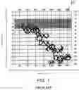 Fig. 02 - Methods and systems for visualizing sound and hearing ability
