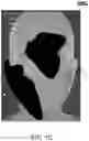 Fig. 03 - Post-split contralateral combinations