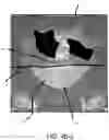 Fig. 10 - Post-split contralateral combinations