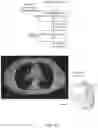 Fig. 05 - Three-dimensional tomography reconstruction pipeline