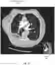 Fig. 06 - Three-dimensional tomography reconstruction pipeline
