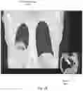 Fig. 07 - Three-dimensional tomography reconstruction pipeline