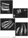 Fig. 09 - Three-dimensional tomography reconstruction pipeline