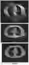 Fig. 10 - Three-dimensional tomography reconstruction pipeline