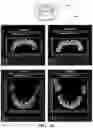 Fig. 19 - Systems and methods for constructing a three-dimensional model from two-dimensional images