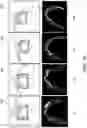 Fig. 20 - Systems and methods for constructing a three-dimensional model from two-dimensional images