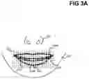 Fig. 06 - Modification of projected structured light based on identified points within captured image
