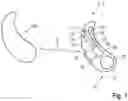 Fig. 02 - Method for operating a hearing system