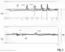 Fig. 06 - Method for operating a hearing system