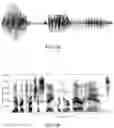 Fig. 06 - Meaning inference from speech audio