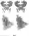 Fig. 23 - PROTEIN COMPLEX STRUCTURE PREDICTION FROM CRYO-ELECTRON MICROSCOPY (CRYO-EM) DENSITY MAPS