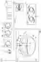 Fig. 02 - SELECTION OF A PREFERRED INTRAOCULAR LENS BASED ON RAY TRACING