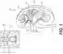 Fig. 02 - Systems and methods for planning medical procedures