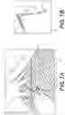 Fig. 08 - Systems and methods for planning medical procedures