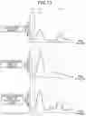 Fig. 11 - ANALYZING APPARATUS AND ANALYZING METHOD