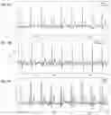 Fig. 20 - NONINVASIVE METHODS FOR DETECTION OF PULMONARY HYPERTENSION