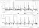 Fig. 21 - NONINVASIVE METHODS FOR DETECTION OF PULMONARY HYPERTENSION