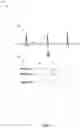 Fig. 02 - SYSTEMS AND METHODS FOR DIAGNOSING A HEALTH CONDITION BASED ON PATIENT TIME SERIES DATA