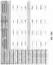 Fig. 23 - SYSTEMS AND METHODS FOR DIAGNOSING A HEALTH CONDITION BASED ON PATIENT TIME SERIES DATA