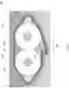 Fig. 04 - Aperiodically overlapping spiral-wrapped cable shield system