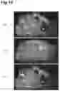 Fig. 11 - IONIZATION METHOD AND MASS SPECTROMETRY METHOD